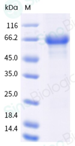 Sino Biological Recombinant Human OX40/TNFRSF4 Protein (hFc Tag), HPLC-verified,
