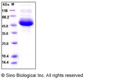 Sino Biological Recombinant Human Cystatin C Protein (His Tag), Quantity: