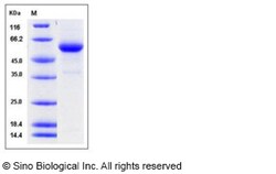 Sino Biological Recombinant Human Cathepsin C Protein (His Tag), Quantity:
