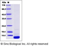 Sino Biological Recombinant Human CCL20/MIP-3 Protein (His Tag), HPLC-verified,