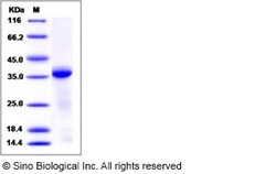 Sino Biological Recombinant Human Cathepsin L Protein (His Tag), HPLC-verified,