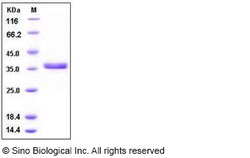 Sino Biological Recombinant Human Cathepsin S Protein (His Tag), HPLC-verified,