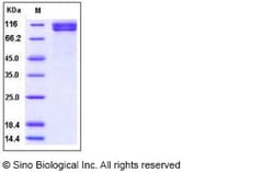 Sino Biological Recombinant Human TCCR/IL-27R alpha Protein (hFc Tag),