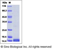 Sino Biological Recombinant Human LEC/CCL16 Protein (His Tag), Quantity: