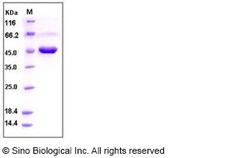 Sino Biological Recombinant Human Carboxypeptidase A2 Protein (His Tag),