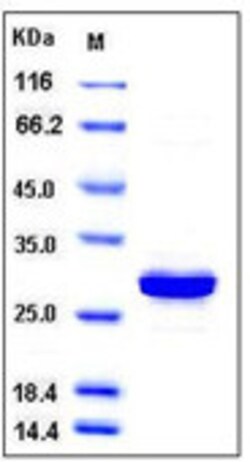 Sino Biological Recombinant Human Carbonic Anhydrase III / CAIII Protein