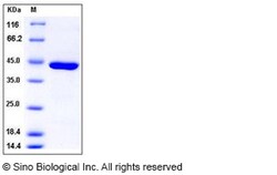 Sino Biological Recombinant Human Carboxypeptidase A Protein (His Tag),