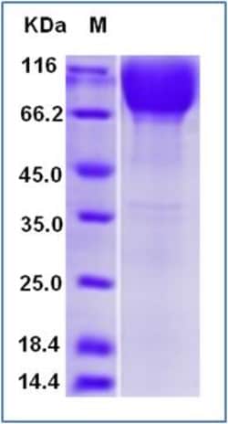 Sino Biological Human PDGFRB / CD140b Protein 100ug, Quantity: Each of