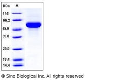 Sino Biological Recombinant Human IL-3R Beta/IL3RB Protein (His Tag), HPLC-verified,