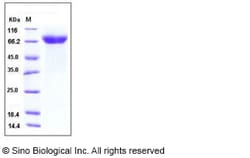 Sino Biological Recombinant Human ADAM15 Protein (His Tag) 100 µg, Quantity:
