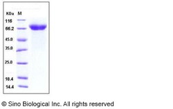 Sino Biological Human ADAM15 / MDC15 Protein (His Tag) 20ug, Quantity: