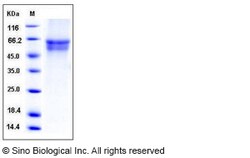Sino Biological Human IL3RA / CD123 Protein (His Tag) 100ug, Quantity: