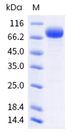 Sino Biological Human IL3Ra Protein 100ug (Sino Biological), Quantity: