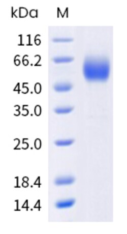 Sino Biological Human IL3Ra Protein 20ug (Sino Biological), Quantity: Each
