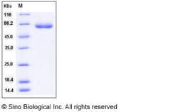 Sino Biological Recombinant Human LBP Protein (His Tag), Quantity: Each