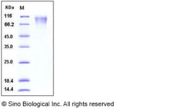 Sino Biological Human CD208 / LAMP3 / DC-LAMP Protein (His Tag) 100ug,