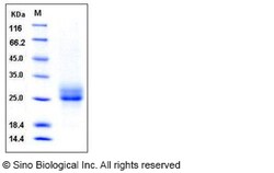 Sino Biological Recombinant Human RELT/TNFRSF19L Protein (His Tag), HPLC-verified,
