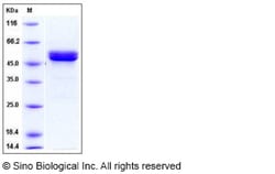Sino Biological Recombinant Human MMP-1 Protein (His Tag), HPLC-verified