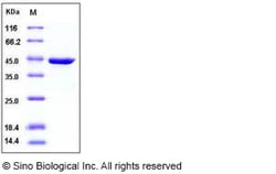 Sino Biological Human RAC1 / MIG5 Protein (GST Tag) 50ug, Quantity: Each