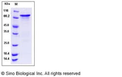Sino Biological Human CHK1 / CHEK1 Protein (GST Tag) 50ug, Quantity: Each