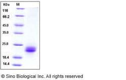 Sino Biological Human VEGF-C Protein (His Tag) 5ug, Quantity: Each of 1