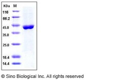 Sino Biological Human ACY1 / Aminoacylase-1 Protein (His Tag) 50ug, Quantity: