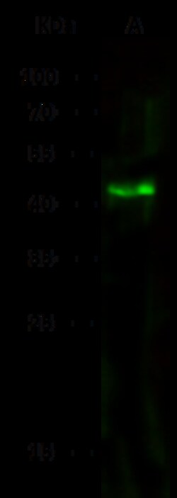 Sino Biological Human ACY1 MAb 100ul (Sino Biological), Quantity: Each