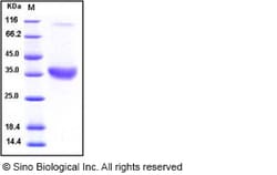 Sino Biological Recombinant Human ACP5 Protein (His Tag), Quantity: Each