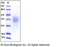 Sino Biological Recombinant Human BMPR2 Protein (His Tag), HPLC-verified