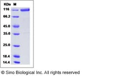 Sino Biological Recombinant Human Urokinase/uPA Protein (His Tag), HPLC-verified,