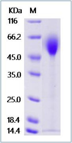Sino Biological Human IL2RG Protein (His Tag) 1mg, Quantity: Each of 1