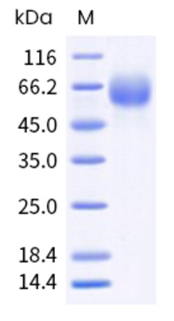 Sino Biological Recombinant Human IL-2R gamma/CD132 Protein (ECD, His &