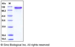 Sino Biological Recombinant Human PDGF alpha receptor/PDGFRA Protein (His