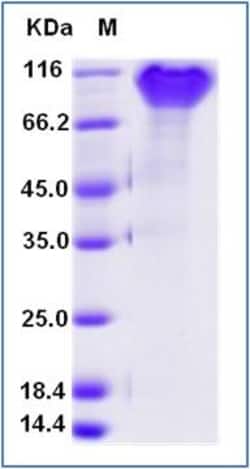 Sino Biological Human PDGFRA / CD140a Protein (His & AVI Tag), Biotinylated