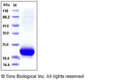 Sino Biological Recombinant Human VEGF-D Protein (His Tag) 100 µg, Quantity: