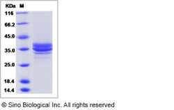 Sino Biological Recombinant Human DC-SIGNR/CD299 Protein (ECD), Quantity: