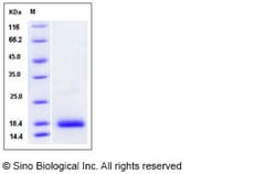 Sino Biological Recombinant Human GDNF Protein, Quantity: Each of 1