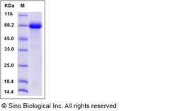 Sino Biological Human ANGPTL4 Protein (Fc Tag) 100ug, Quantity: Each of