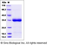 Sino Biological Recombinant Human ANGPTL4 Protein (His Tag), Quantity: