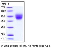 Sino Biological Recombinant Human DNAM-1/CD226 Protein (ECD, His Tag),