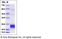 Sino Biological Human NKG2D / CD314 Protein (aa 78-216, His Tag) 100ug,