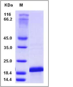 Sino Biological Human IL36B / IL1F8 Protein (His Tag) 20ug, Quantity: Each