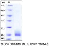 Sino Biological Recombinant Human ALK4/ACVR1B Protein (His Tag), HPLC-verified