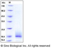 Sino Biological Human ALK4 / ACVR1B Protein (His Tag) 100ug, Quantity: