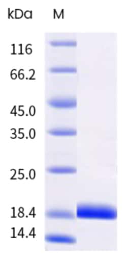Sino Biological&nbsp;Recombinant Human IL-21 Protein, Biotinylated, HPLC-verified 100 µg