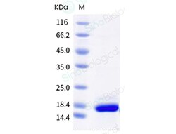 Sino Biological Human Interleukin-21 / IL-21 Protein 20ug, Quantity: Each