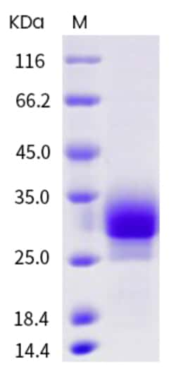 Sino Biological Recombinant Human SOST/Sclerostin Protein (His Tag), Quantity: