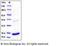 Sino Biological Human TNF-alpha / TNFA Protein 100ug, Quantity: Each of