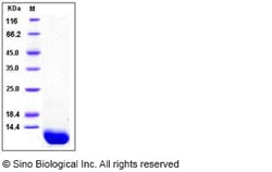 Sino Biological Recombinant Human Complement C5 Protein (C5a), HPLC-verified,