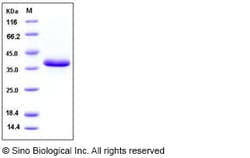 Sino Biological Recombinant Human EGF Protein (ECD, hFc Tag), Quantity: